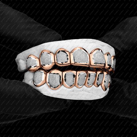 Rose Gold Diamond Dust Punchout Grillz - Buy Now