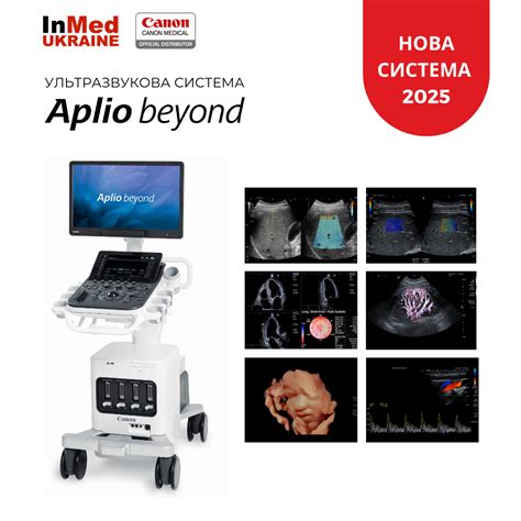 Презентуємо новинку від canon medical ультразвукову систему aplio beyond