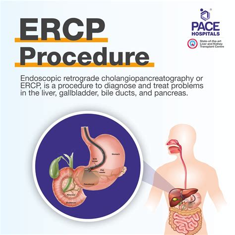 ERCP Procedure in Hyderabad | Surgery & Test Cost