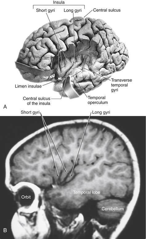 The Telencephalon - Clinical Tree