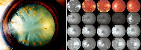 B B Eye Foundation : Book Appointment 9163940000 | Eye Care Centre ...