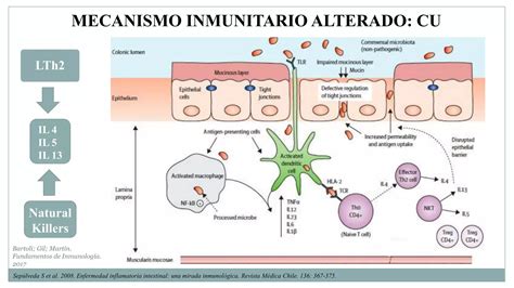 ENFERMEDAD INFLAMATORIA INTESTINAL (EII) ENFERMEDAD DE CROHN (EC) COLITIS ULCEROSA (CUCI) | PDF ...