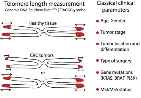 Measurement of Telomere Length in Colorectal Cancers for Improved ...
