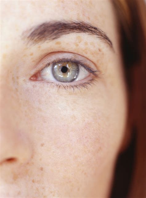 How to Get Rid of Floaters in My Eyes? | University of Utah Health
