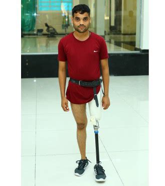 Best Artificial Limbs Cost in India - Artificial Prosthetic Leg Centre ...