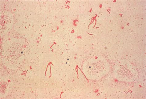 Yersinia enterocolitica flagella | Encyclopedia MDPI
