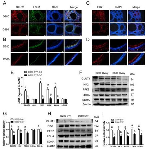 Follicle-Stimulating Hormone Alleviates Ovarian Aging by Modulating ...