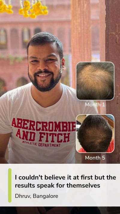 Traya Centres | Personalised Hair & Scalp Care