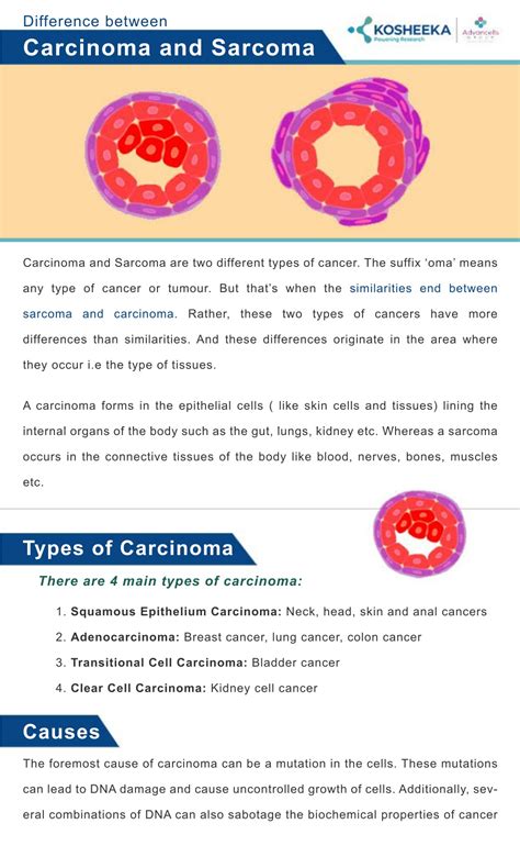 Sarcoma Vs Carcinoma