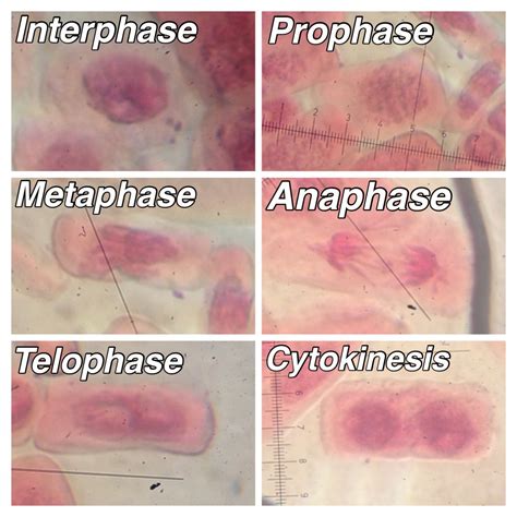 Cell Division Mitosismeiosis And Different Phases Of