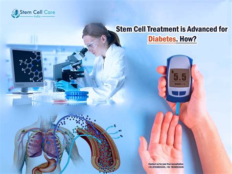 Stem Cell Treatment is Advanced for Diabetes. How? | Home