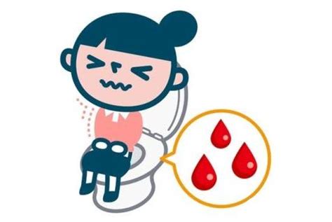 便血是由什么疾病造成的你知道吗？