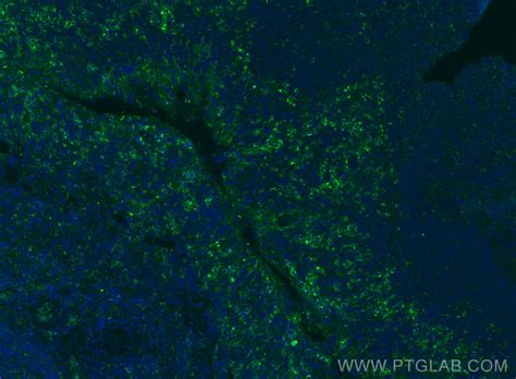 VISTA antibody (31619-1-AP) | Proteintech