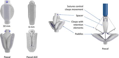 The PASCAL Transcatheter Valve Repair System: A User’s Guide - Structural Heart
