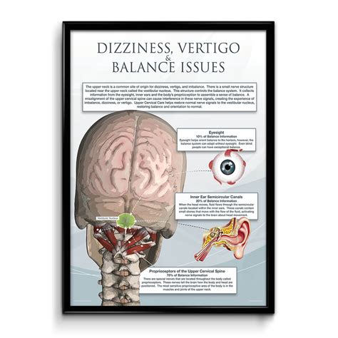 Upper Cervical Specific Chiropractic Posters - Digital Chiropractic Marketing | Upper Cervical ...