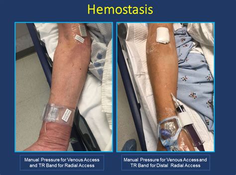 Cardiac Catheterization