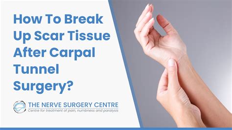 How To Break Up Scar Tissue After Carpal Tunnel Surgery - The Nerve Surgery Centre