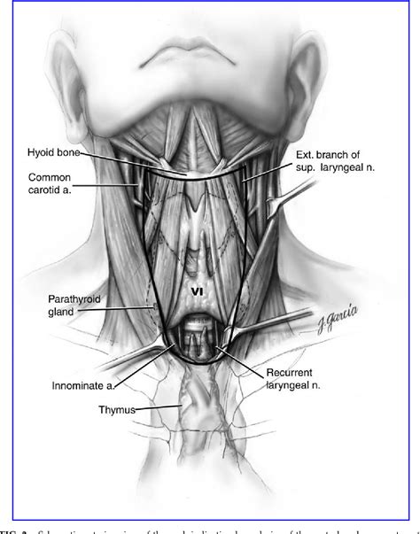 What Is Enlarged Right Paratracheal Lymph Node at Victoria Melrose blog