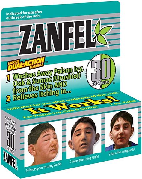 ZANFEL - Clinically Proven Poison Ivy, Oak & Sumac Wash, Urushiol Toxin ...
