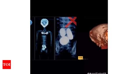 Image result for Alien Skull Found in Mexico