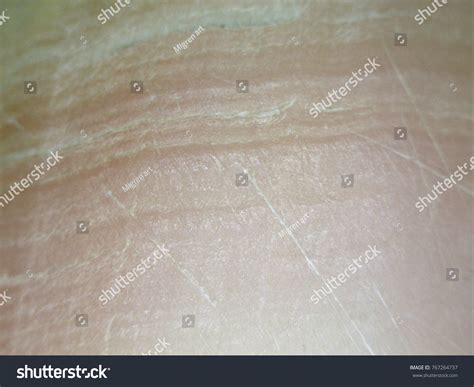 Image result for Microscope Toes