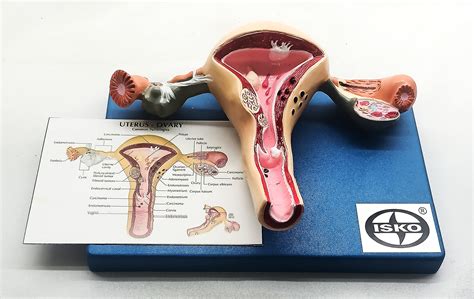 Buy ISKO® Uterus And Ovary Model Female Reproductive Organ Model Human Anatomy Replica Show ...