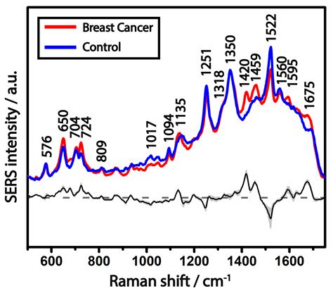 Breast Cancer Diagnosis by Surface-Enhanced Raman Scattering (SERS) of ...