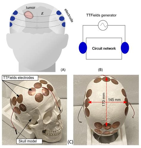Evaluating the therapeutic effect of tumor treating fields (TTFields ...