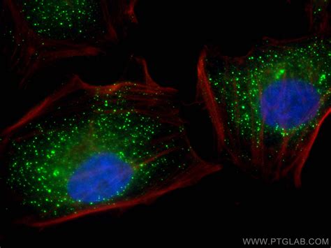 C12orf29 antibody (31647-1-AP) | Proteintech
