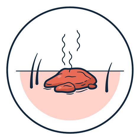 Can Humans Get Fleas From Dogs: 5 Signs of Fleas - PetFriendly Box