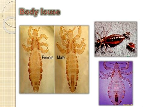 PPT - Lice PowerPoint Presentation, free download - ID:1291513