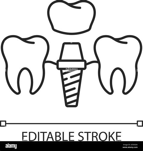 Dental implants procedure linear icon Stock Vector Image & Art - Alamy