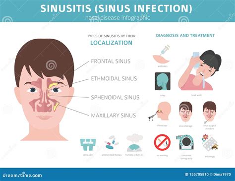 Sinus Cancer: Signs, Symptoms, And Complications – LMTYW