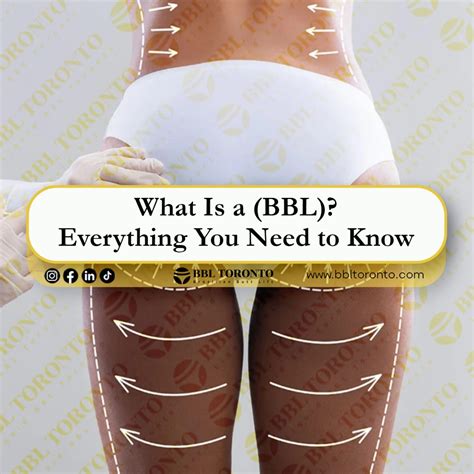 What Is a (BBL)? Everything You Need to Know - Liquid BBL Toronto | Non-Surgical BBL Toronto