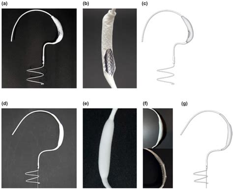 The Development of a Permanent Implantable Spacer with the Function of ...
