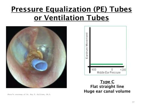 PPT - OTOSCOPIC EXAMINATION and TYPANOMETRY BASICS PowerPoint ...