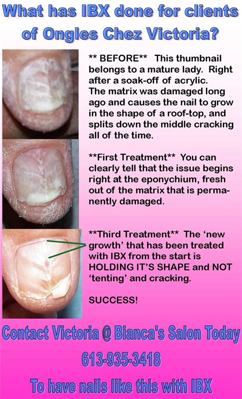 Fact check how does ibx nail strengthening treatment work – Artofit
