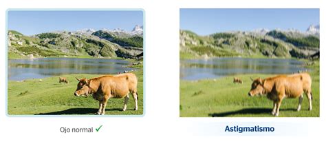 O Que é Astigmatismo E Hipermetropia - NAZAEDU