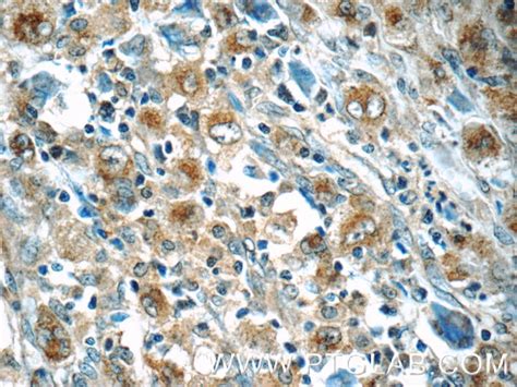 IL-21R antibody (10533-1-AP) | Proteintech