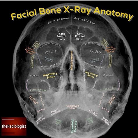 Nasal bones radiographic anatomy – Artofit
