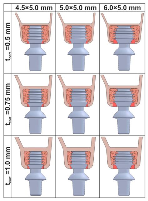Regenerated Bone Quality as a Determinant of Bone Turnover and ...