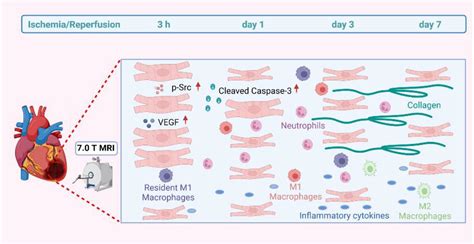Frontiers | Characterization of early myocardial inflammation in ischemia-reperfusion injury
