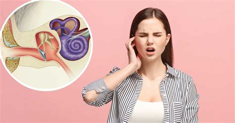 Otosclerosis - masqueaudifonos.com