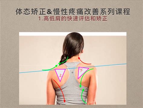 高低肩矫正中被忽略的重要一点——肩胛骨的位置 - 知乎