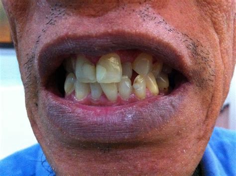 MEDICAL PHOTOGRAPHY AND VIDEOS, MEDICAL PHOTOGRAPHY: TOOTH DISEASE ...