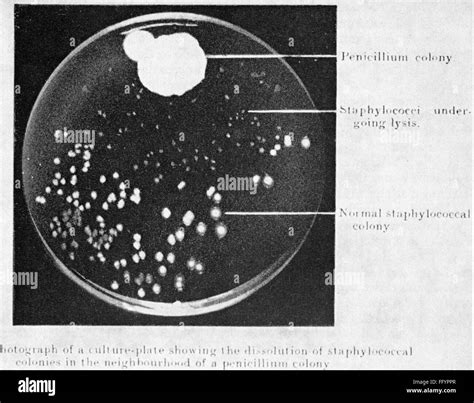 How Penicillin Was Discovered What Was Fleming S Hypothesis at Hazel Peterson blog