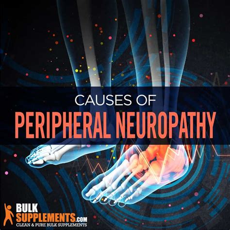 Peripheral Neuropathy Improvement at Rebecca Guay blog