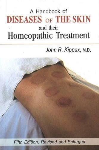 Buy A Handbook Of Diseases Of Skin And Thier Homeopathic Treatment- 5Th ...