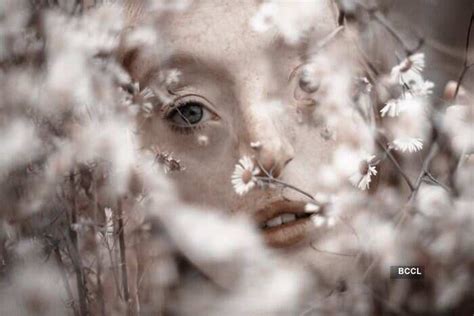 Rare facial defect doesn't stop this German model Ilka Brühl from ...