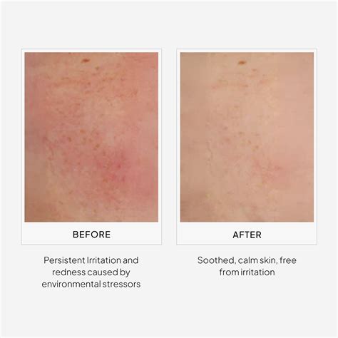 Best Skin Brightening Antioxidant Day Serum | All Skin Types